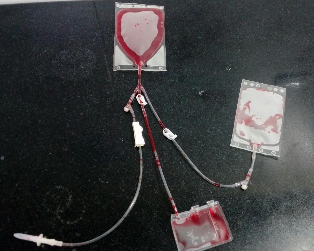 Freezing Transfer Bags