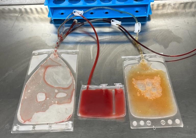 Freezing Transfer Bags